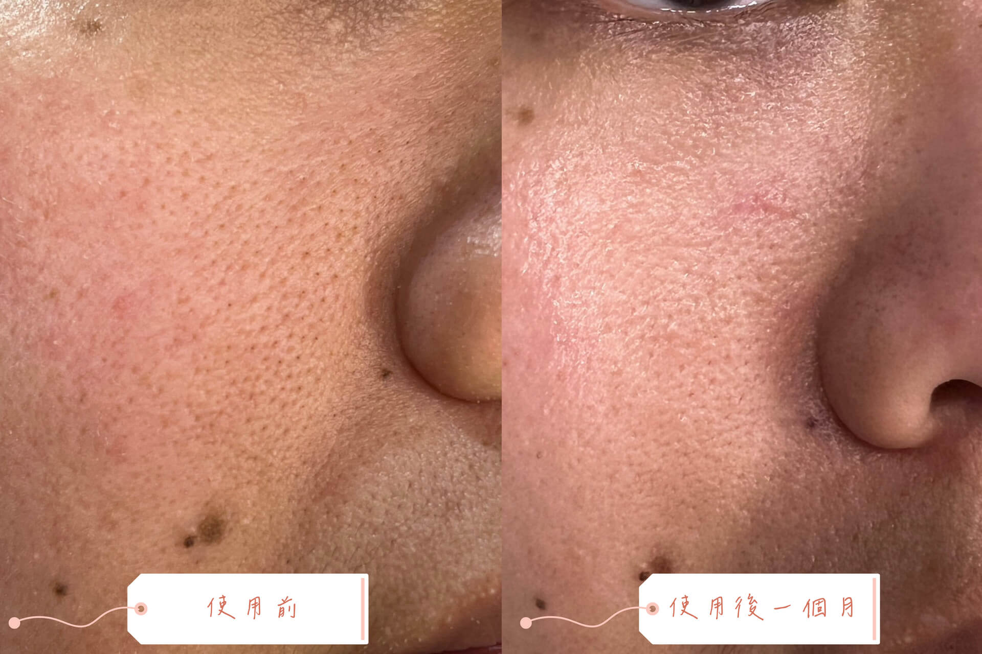 泥膜使用前後對比