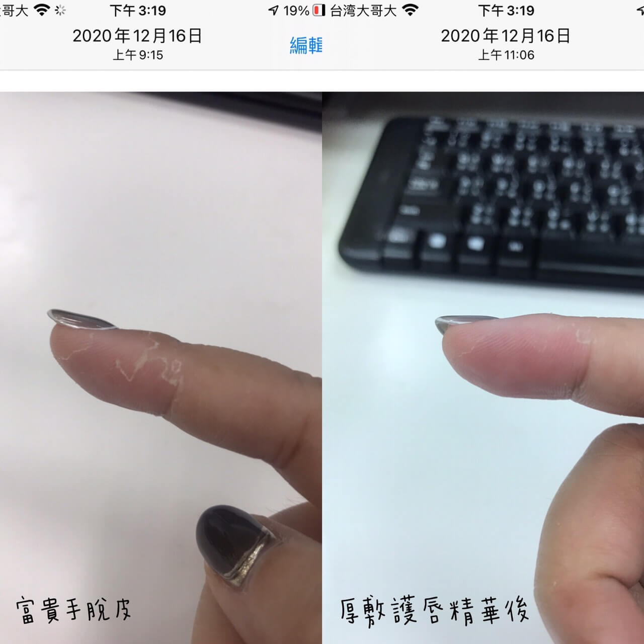 護唇精華修護富貴手