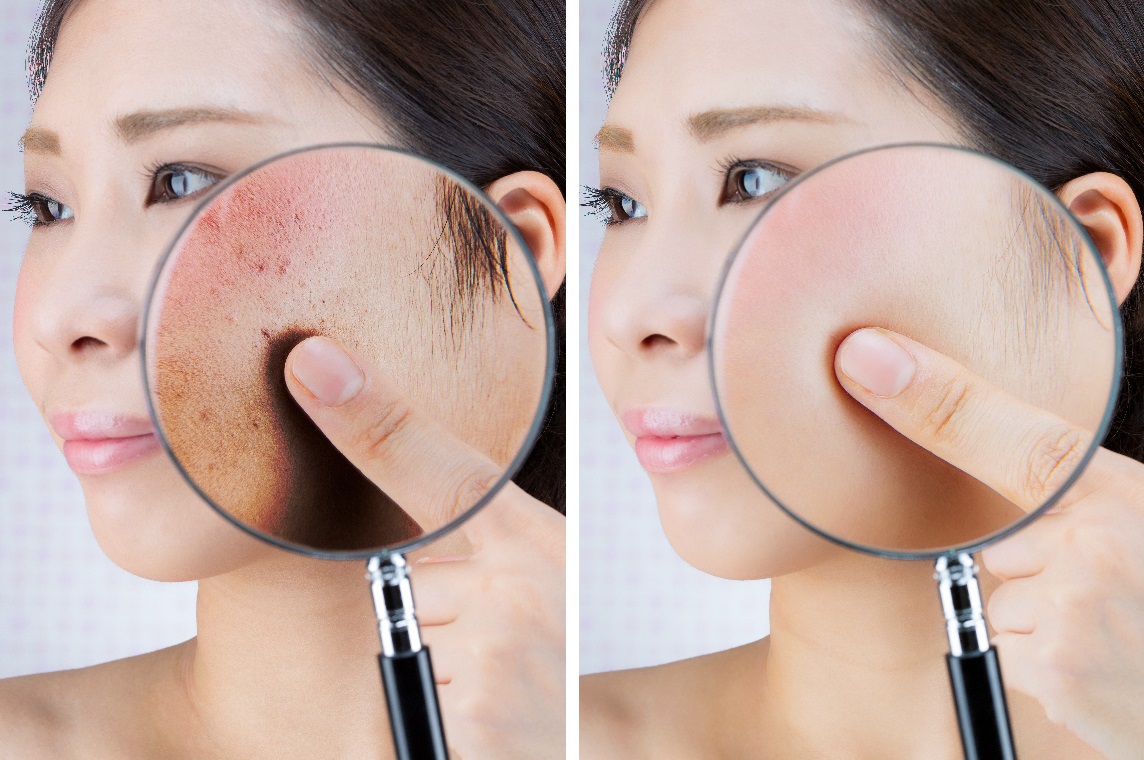 6種肌膚亮白日常保養法,幫你擺脫黑斑暗沉