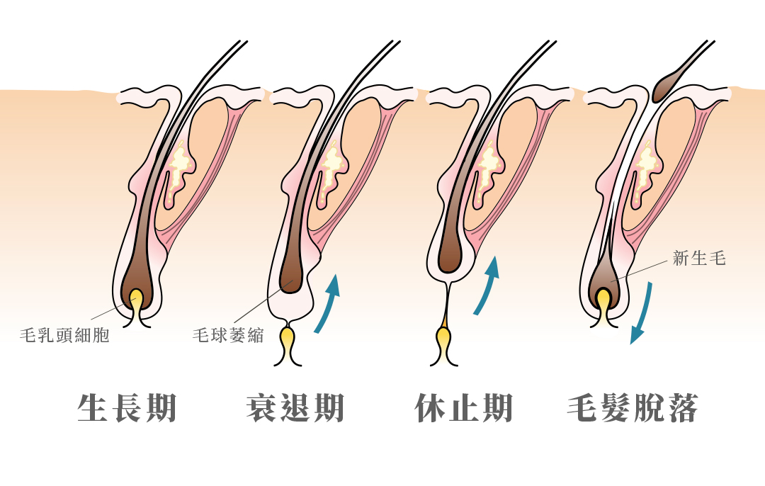 頭髮的生長週期(Hair Growth Cycle)可以分為三個階段:生長期(Anagen) 衰退期(Catagen)休止期(Telogen)