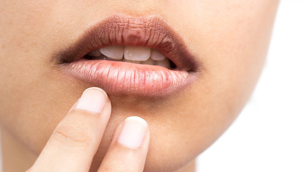 嘴唇也會老化