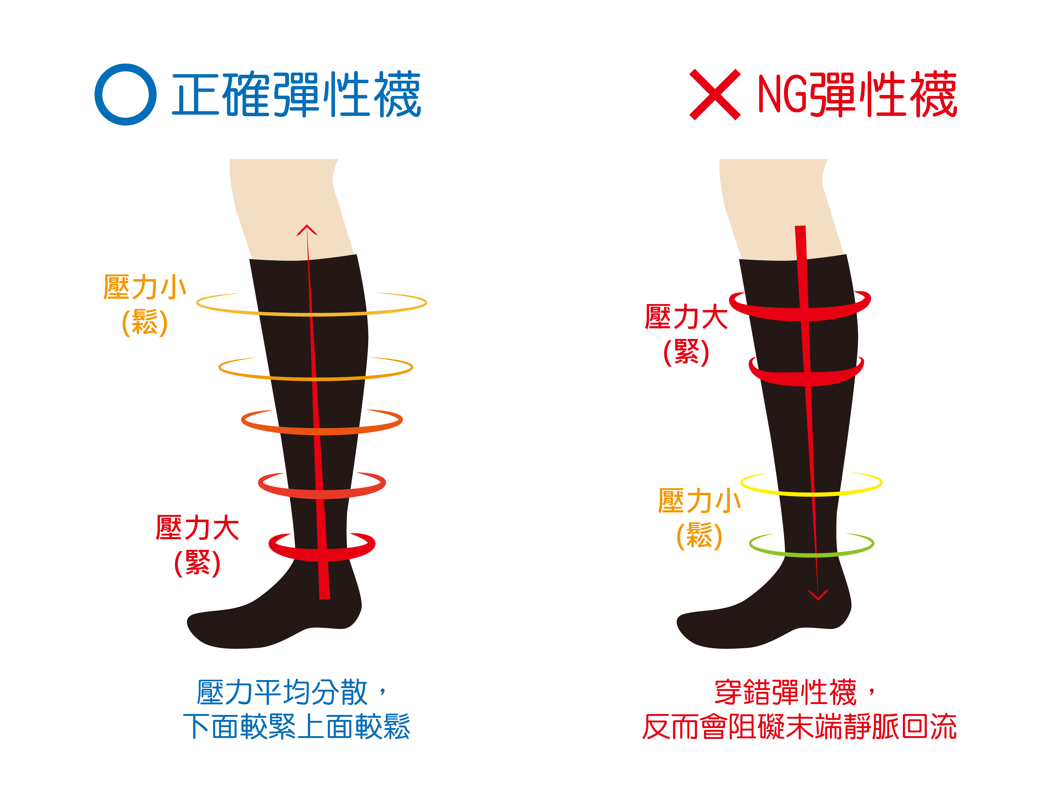 醫療級彈性襪與一般彈性襪的不同