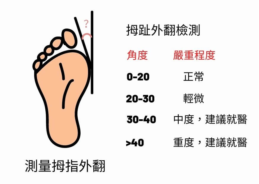 拇指外翻自我檢測