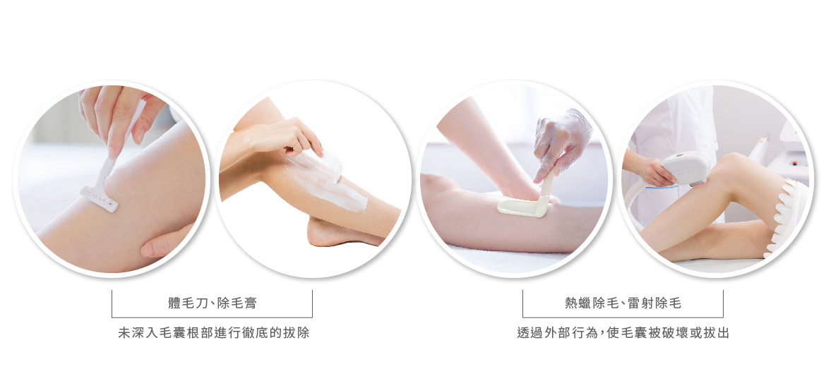 比較常見的除毛方式