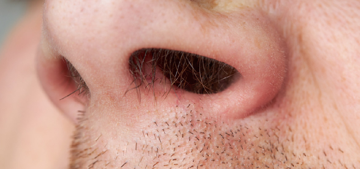 男生除毛推薦-鼻毛