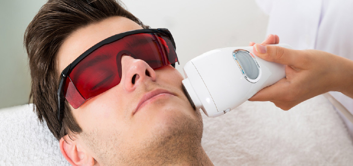 男生除毛推薦的除毛工具-雷射除毛