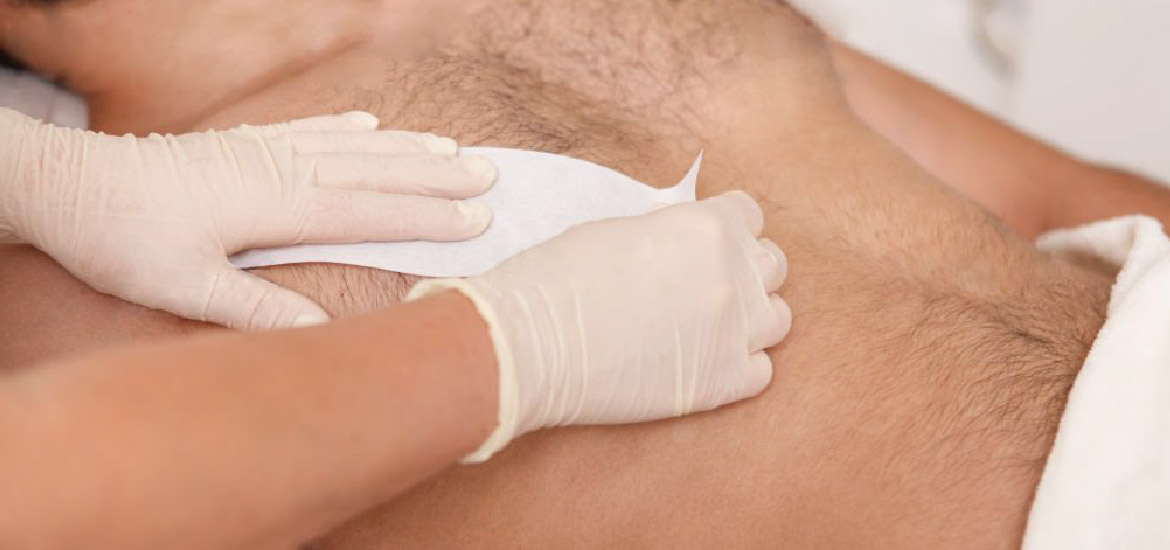 什麼是男性熱蠟除毛