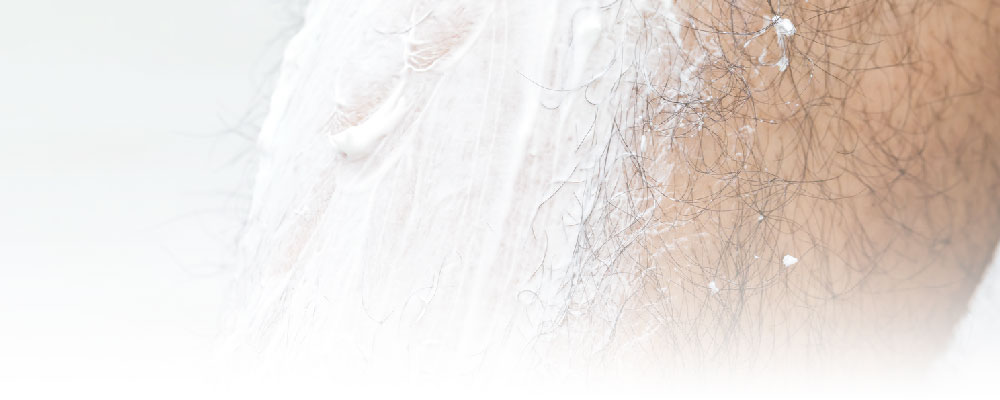 居家除毛方式-除毛膏