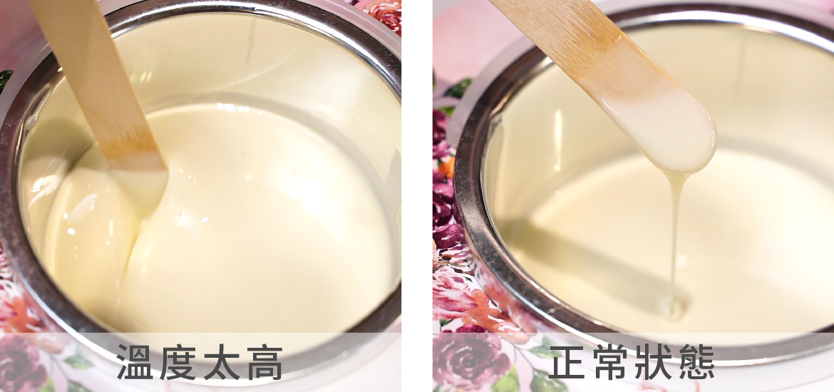 熱蠟除毛時–溫度太高