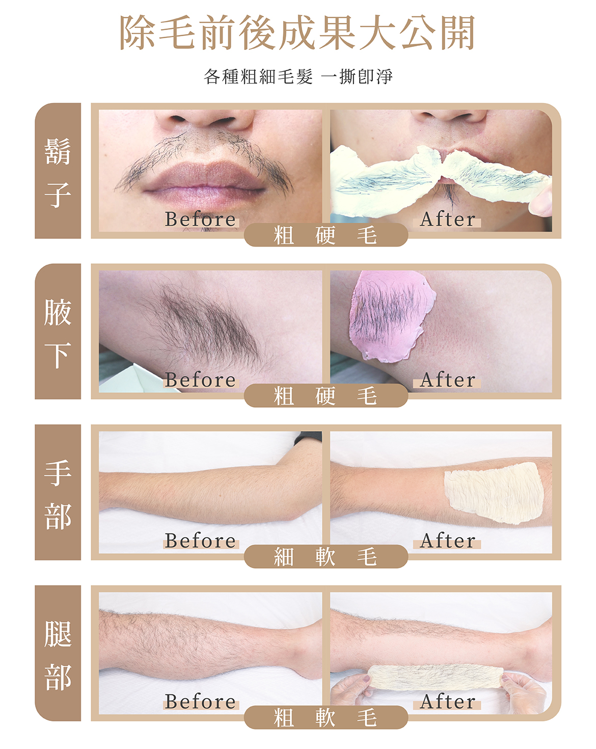 除毛成果大公開