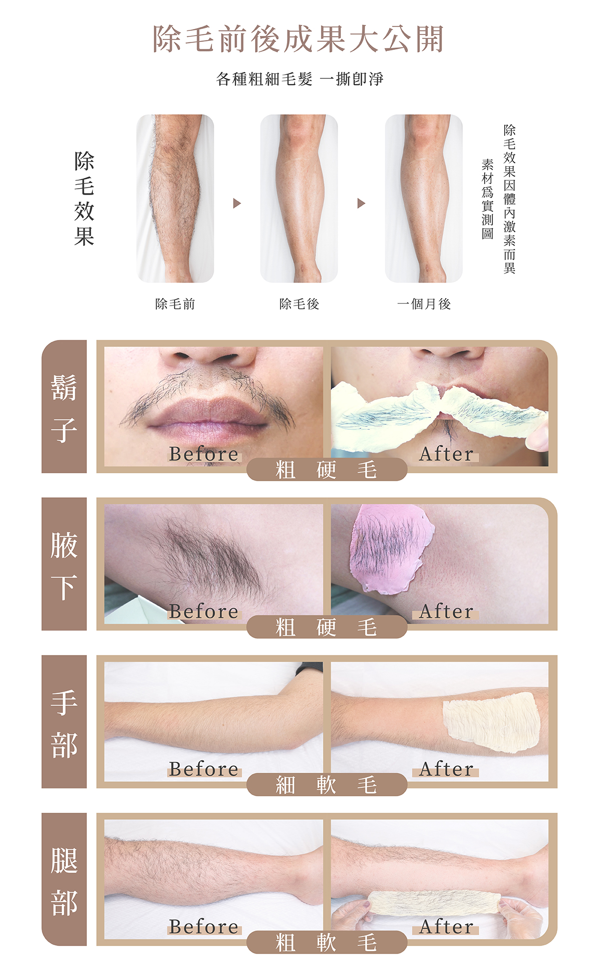 除毛前後成果大公開