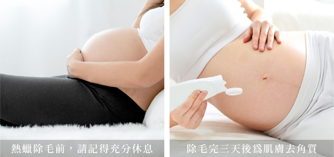 孕婦除毛前、後注意事項