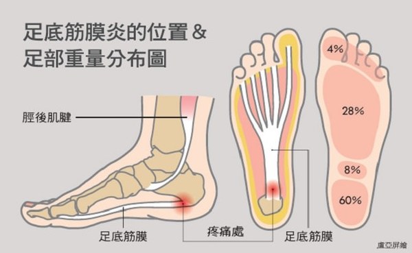APROX雅伯斯抑菌除臭壓力五指襪,採抗菌紗,足弓加壓穩固腳底肌肉,舒緩拇趾外翻疼痛,預防足底筋膜炎、腳底痛。五指襪有效平衡身體重心、提高腳趾抓地力