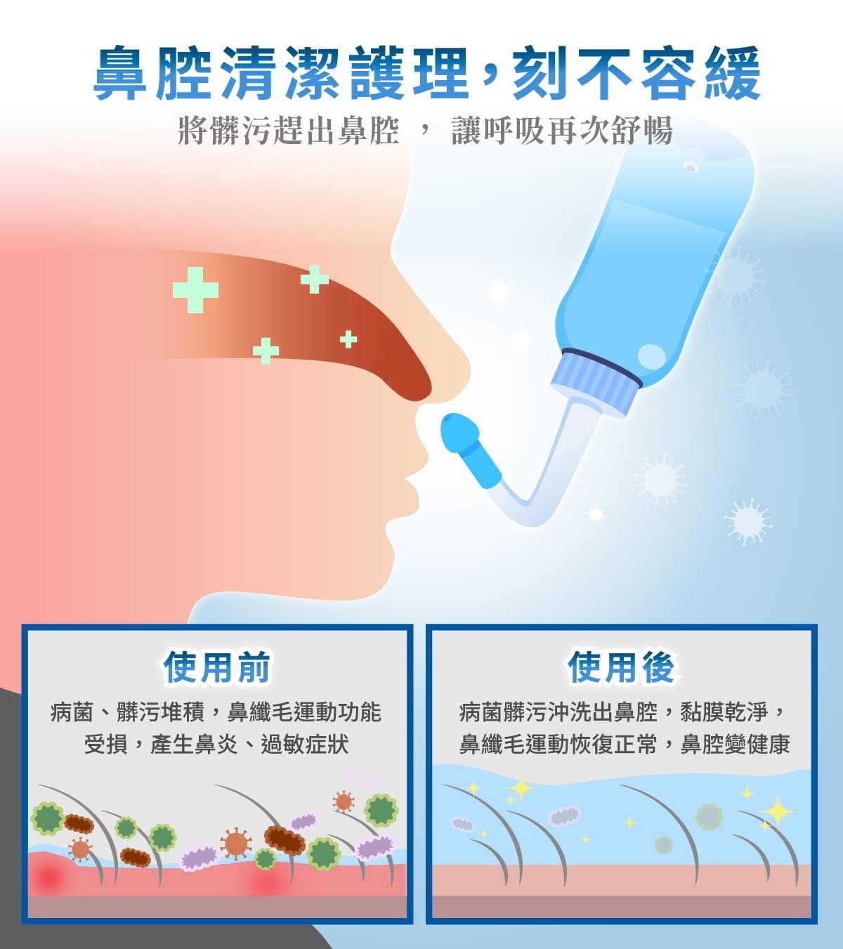 洗鼻清潔鼻子,改善鼻過敏、鼻炎