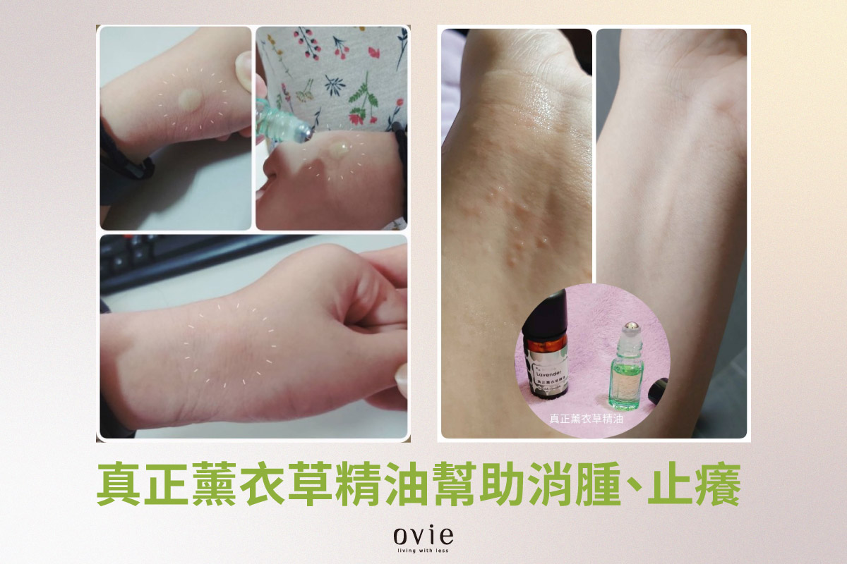 小孩被蚊子叮怎麼辦?薰衣草精油能幫小孩被蟲咬處消腫、止癢