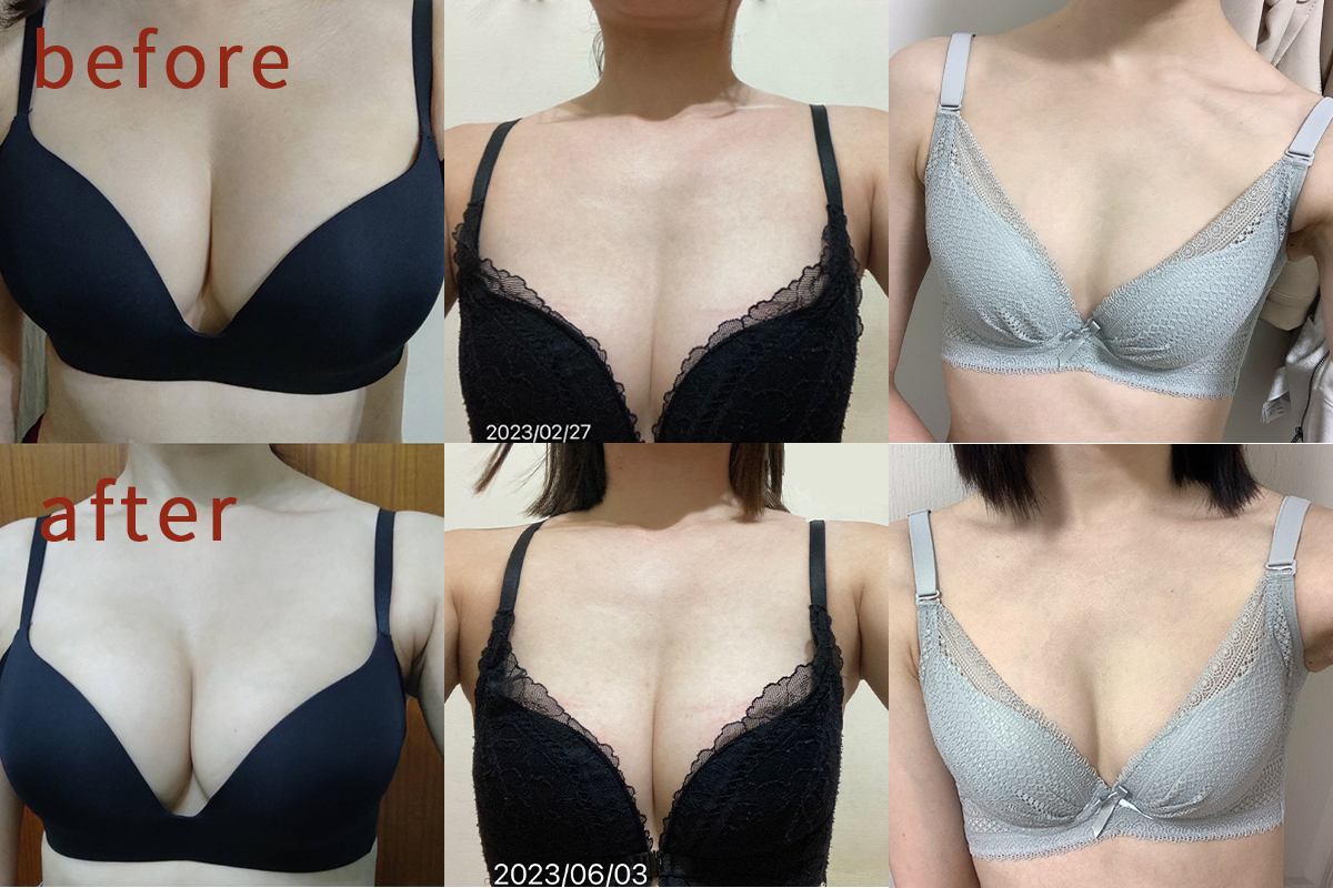 Ovie美豐美滿精油豐胸實測