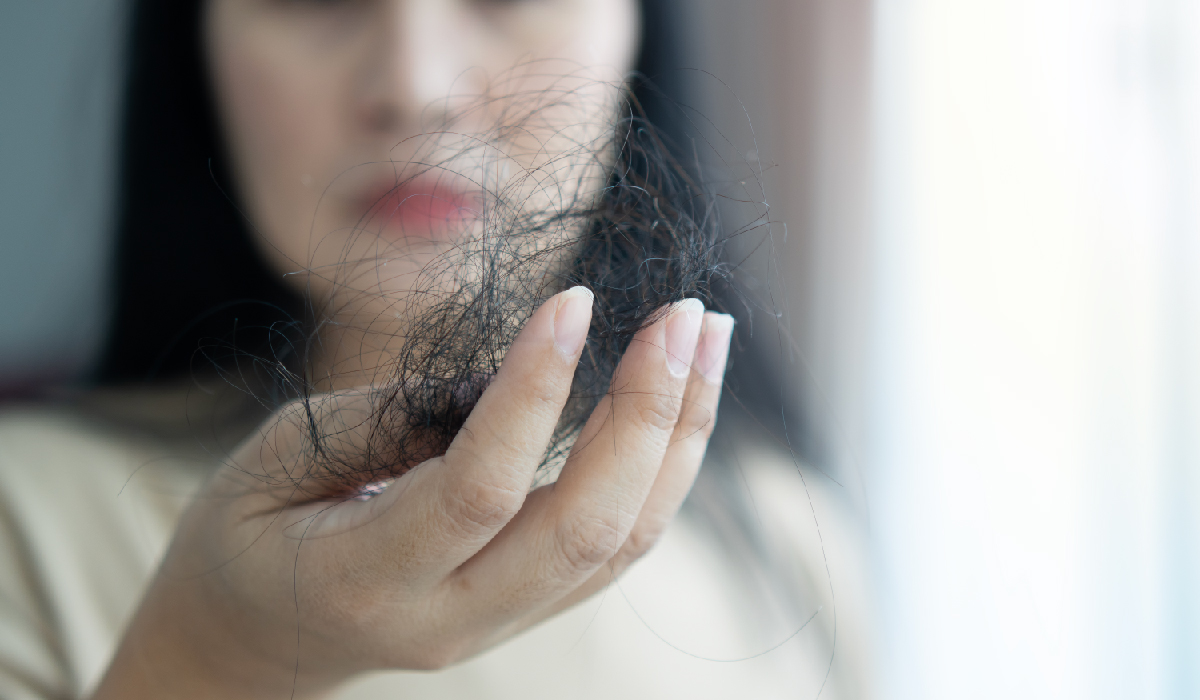 你也有頭皮老化的困擾嗎?這些初老徵兆快看看
