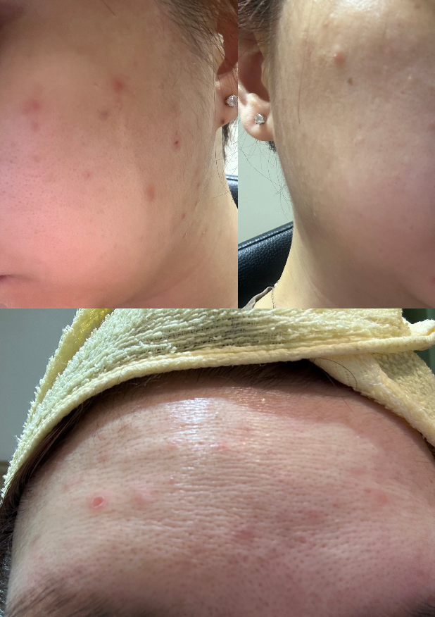 為什麼選擇hui奇肌舒緩修護霜?修護霜的多重功效