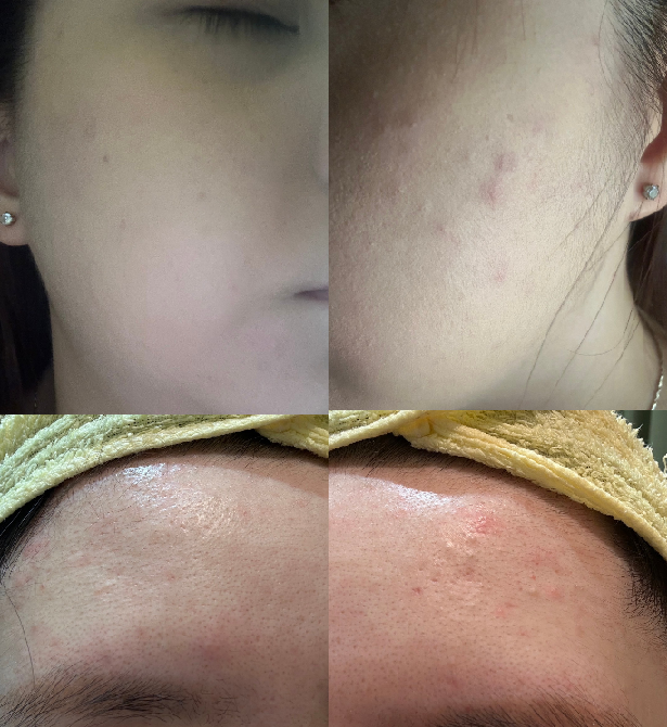 使用hui奇肌舒緩修護霜的感受