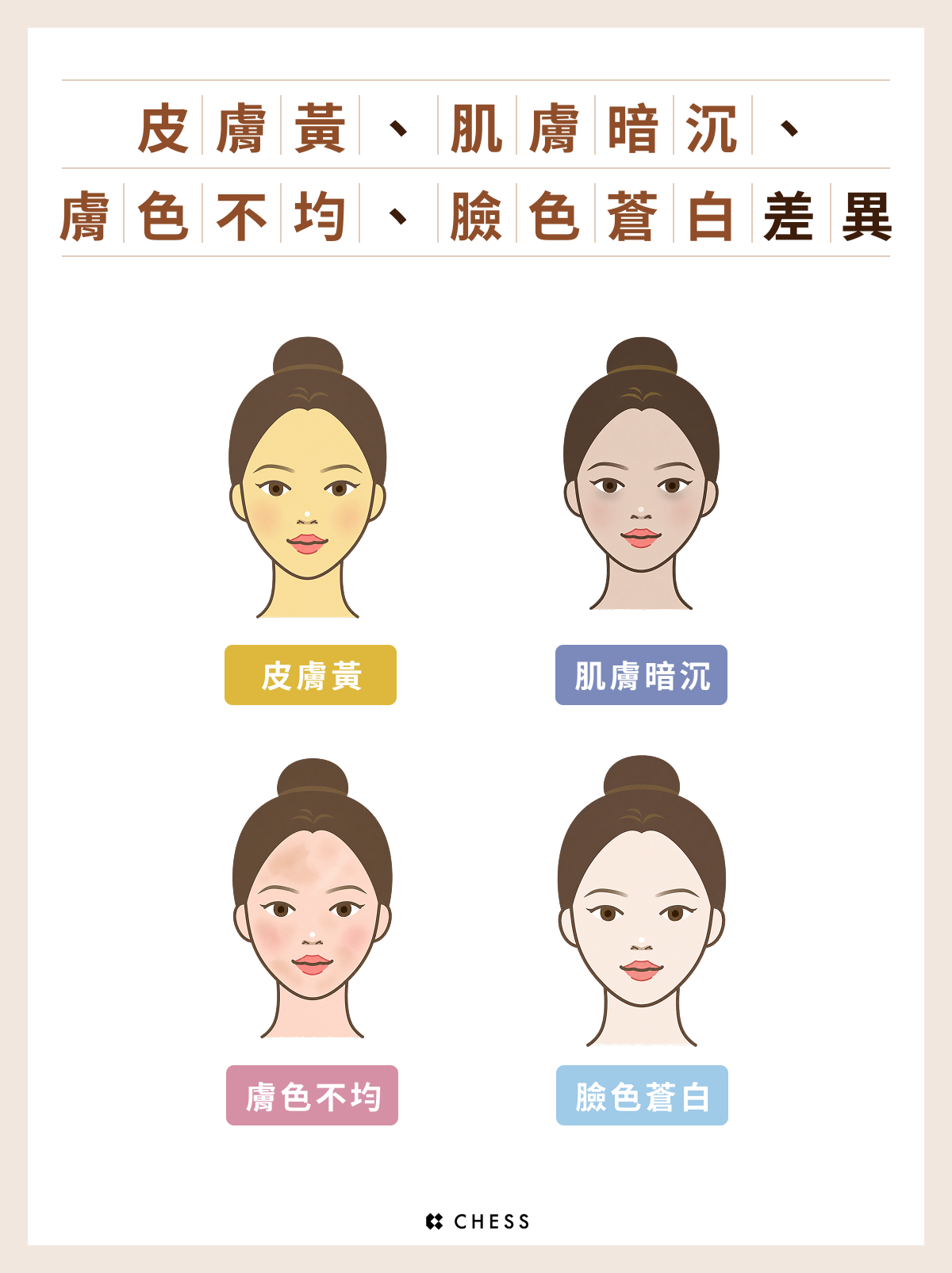 皮膚黃、肌膚暗沉、膚色不均、臉色蒼白示意圖