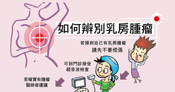 【A4海報】如何辨別乳房腫瘤