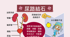 【A4海報】尿路結石