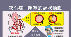 【A4海報】冠狀動脈疾病