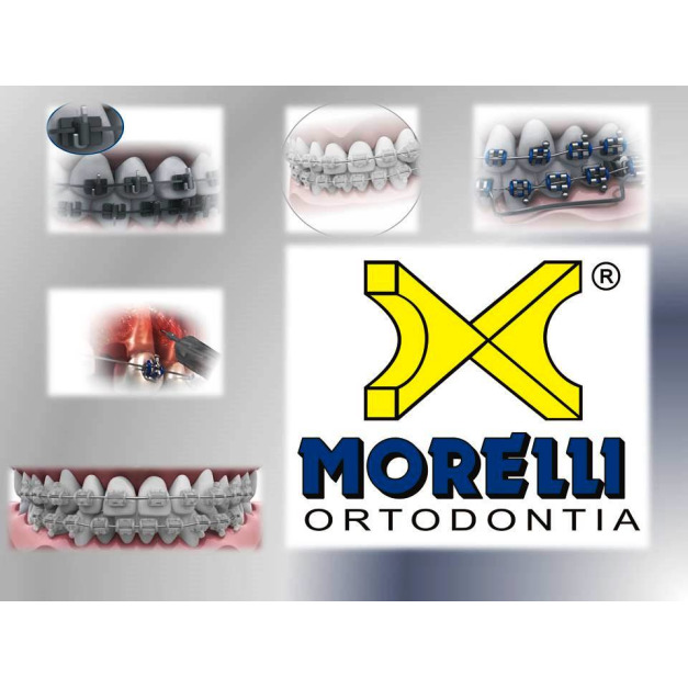 Morelli 矯正器