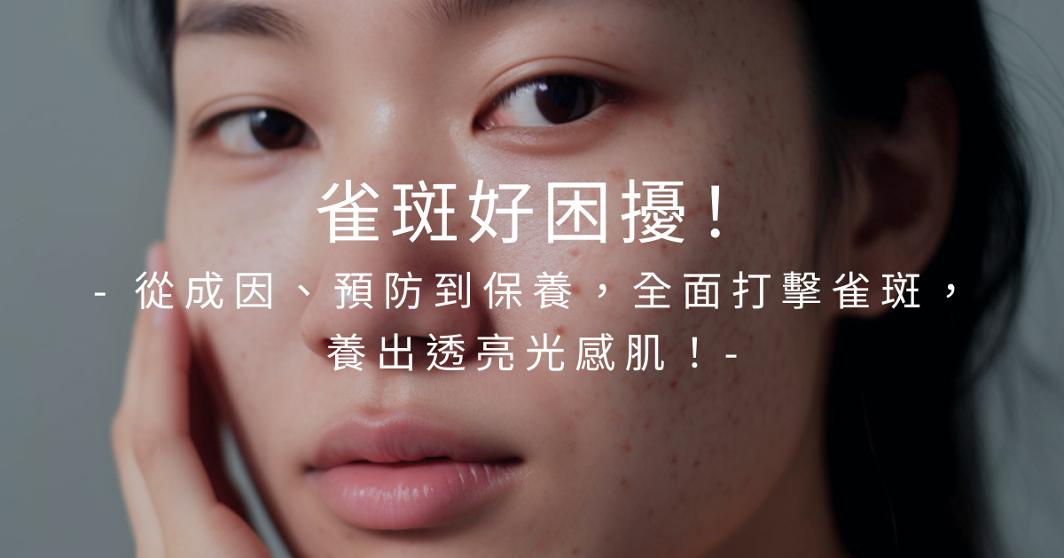 雀斑好困擾！從成因、預防到保養，全面打擊雀斑，養出透亮光感肌！