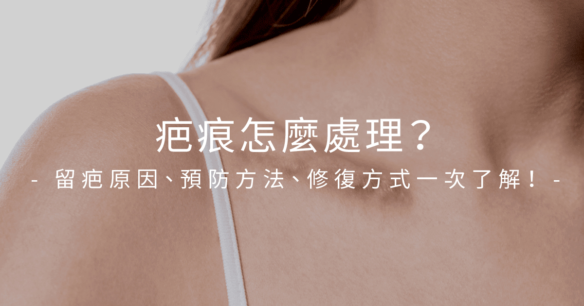 預防疤痕這樣做！一篇帶你看懂傷口疤痕成因、淡疤方法！