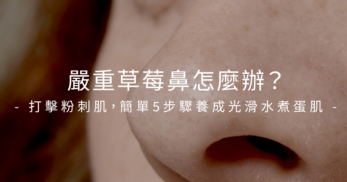 嚴重草莓鼻怎麼辦？打擊粉刺肌，簡單5步驟養成光滑水煮蛋肌