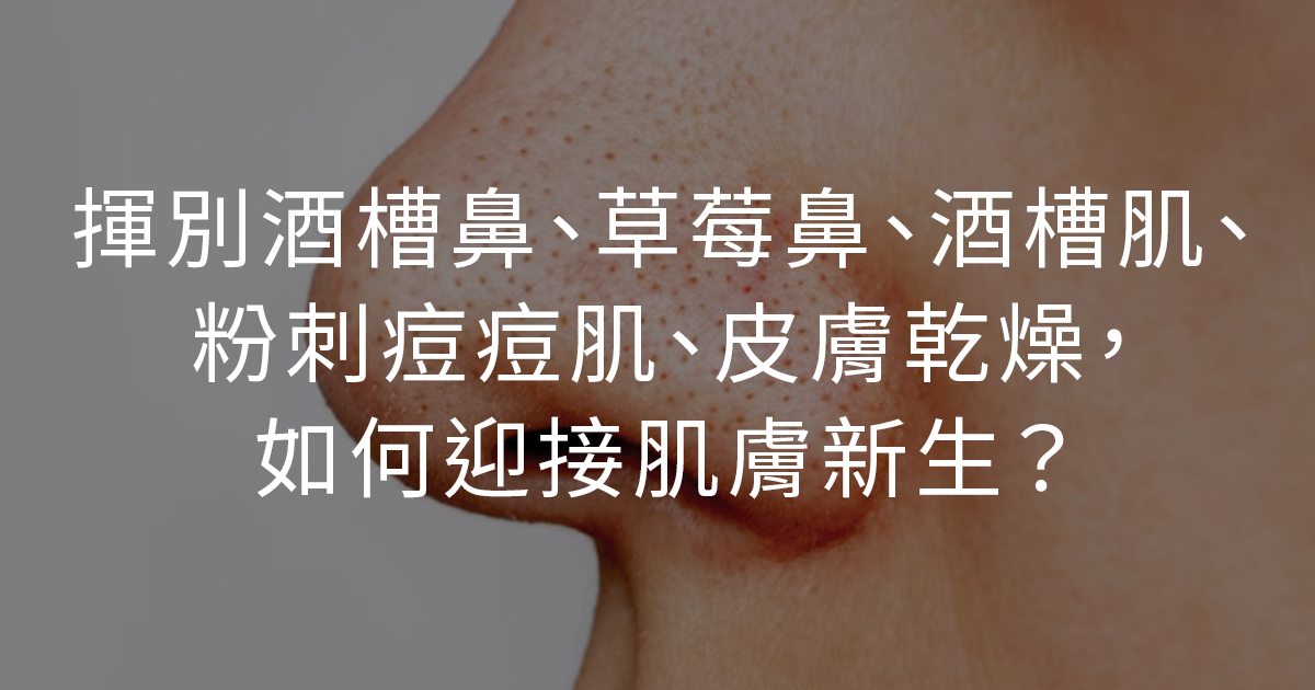 揮別酒槽鼻、草莓鼻、酒槽肌、粉刺痘痘肌、皮膚乾燥，如何迎接肌膚新生？