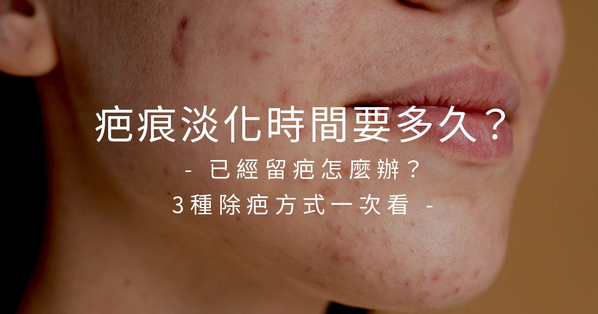 疤痕淡化時間要多久？已經留疤怎麼辦？3種除疤方式一次看