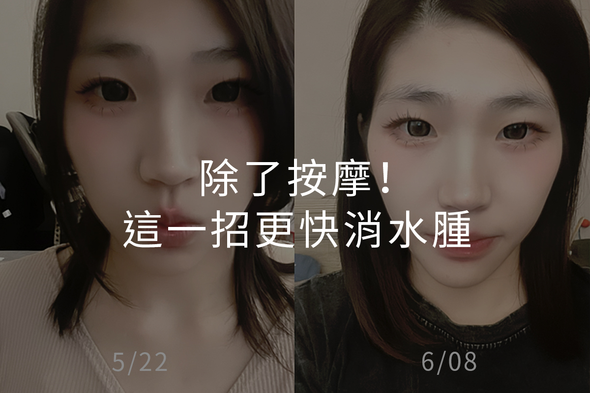 除了按摩！這一招更快消水腫