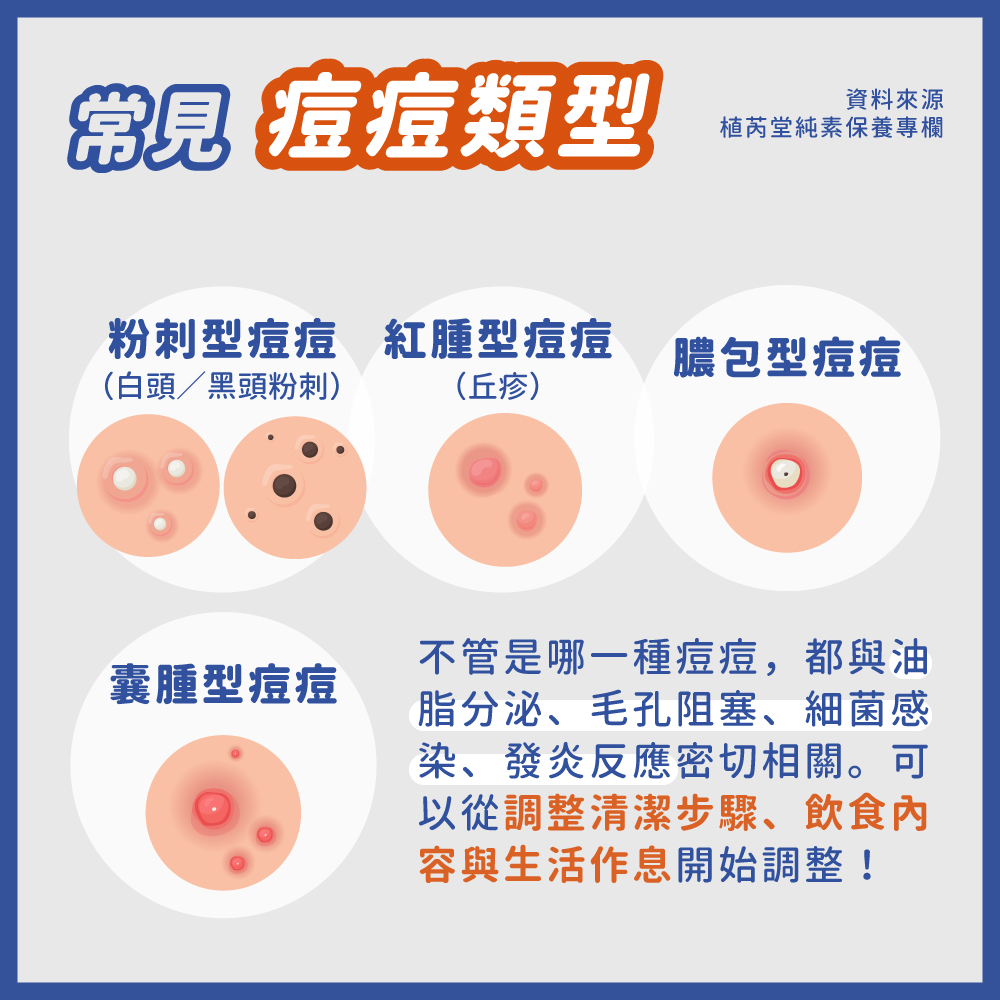 一直長痘痘?先搞懂痘痘類型才好治療!