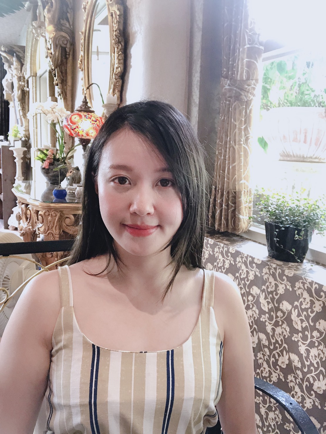 自體脂肪補臉一個月