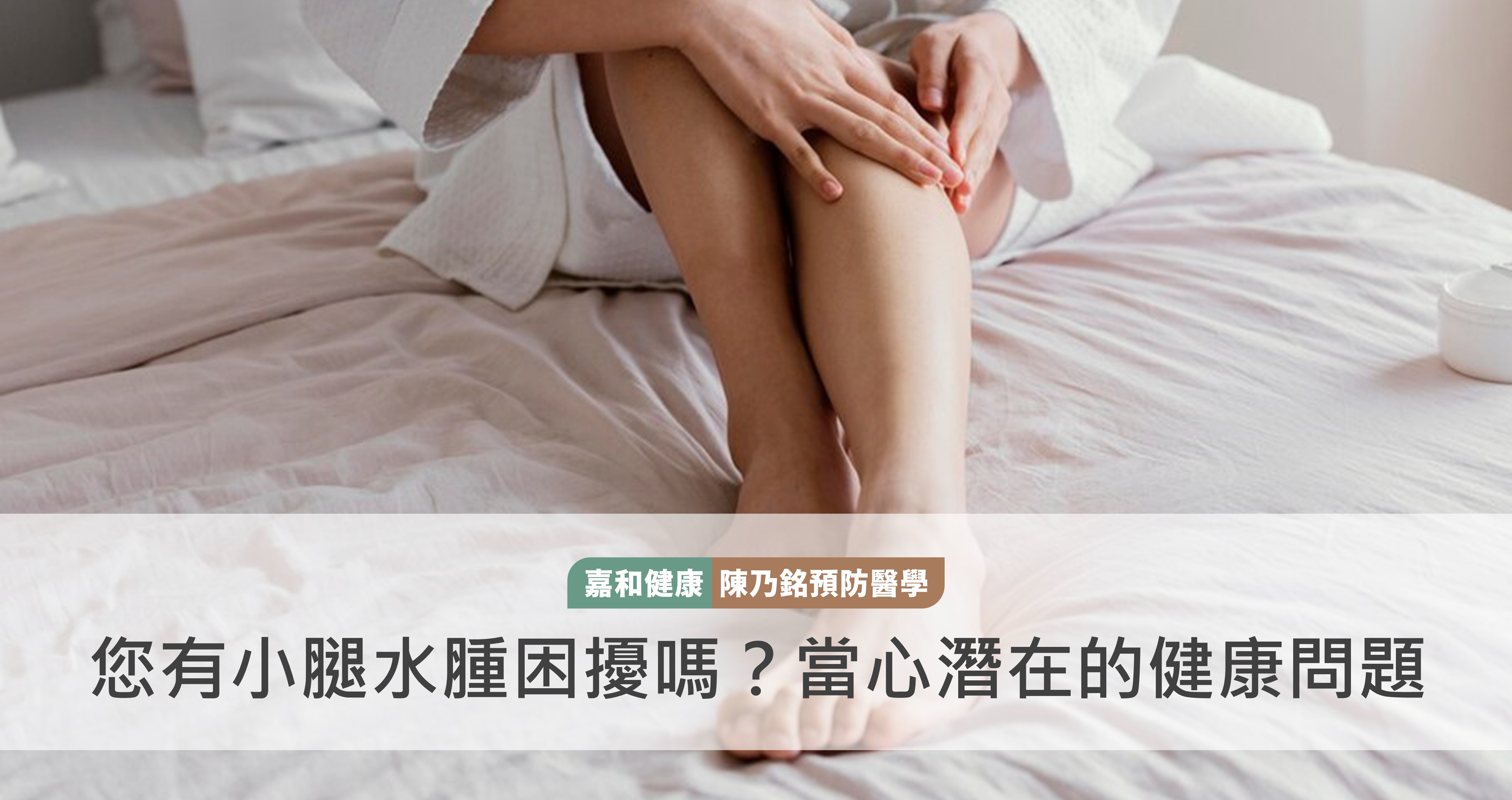 您有小腿水腫困擾嗎？當心潛在的健康問題