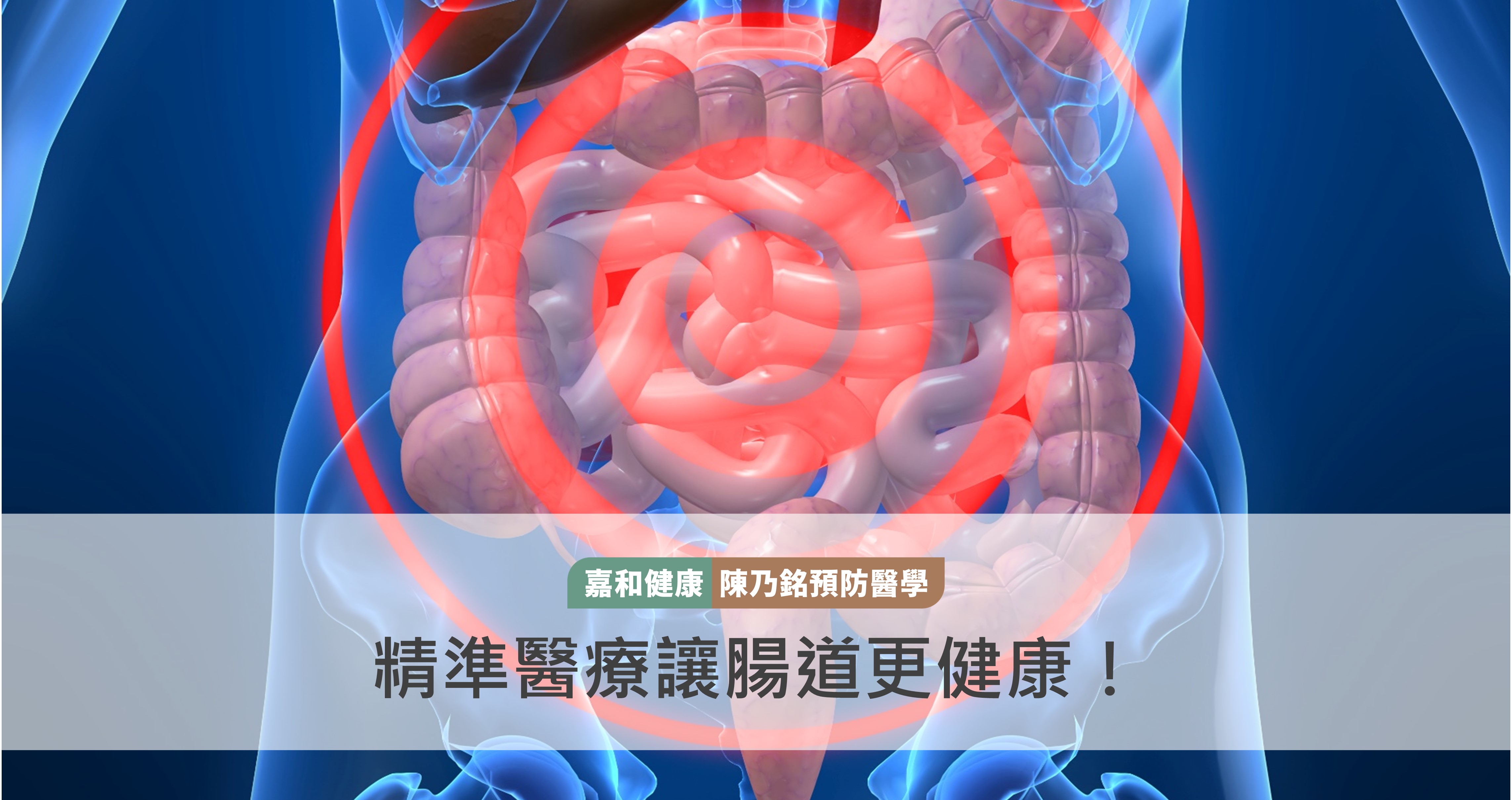精準醫療讓腸道更健康！