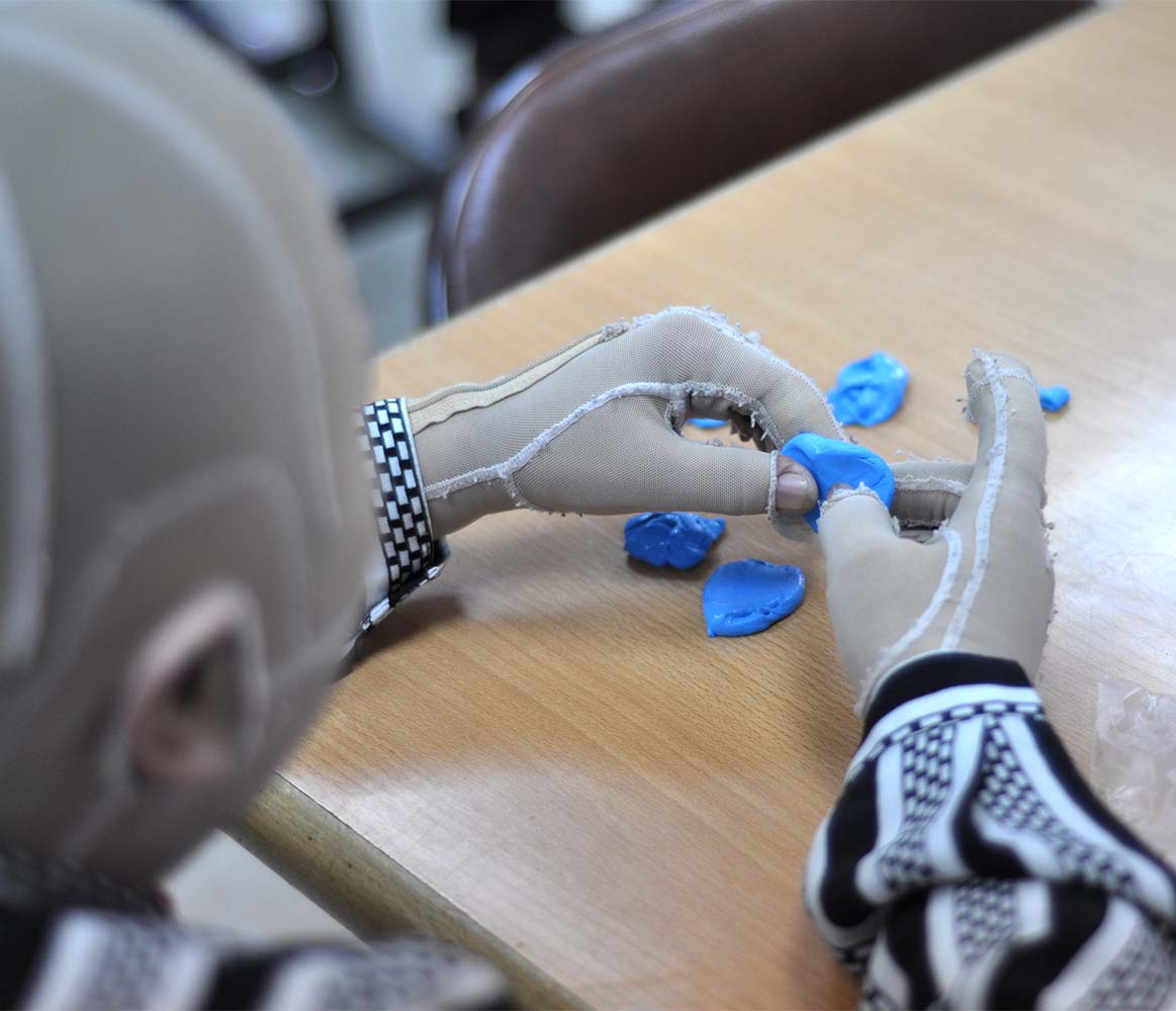 bagrun x 陽光基金會，邀你一起協助燒傷患者重建人生