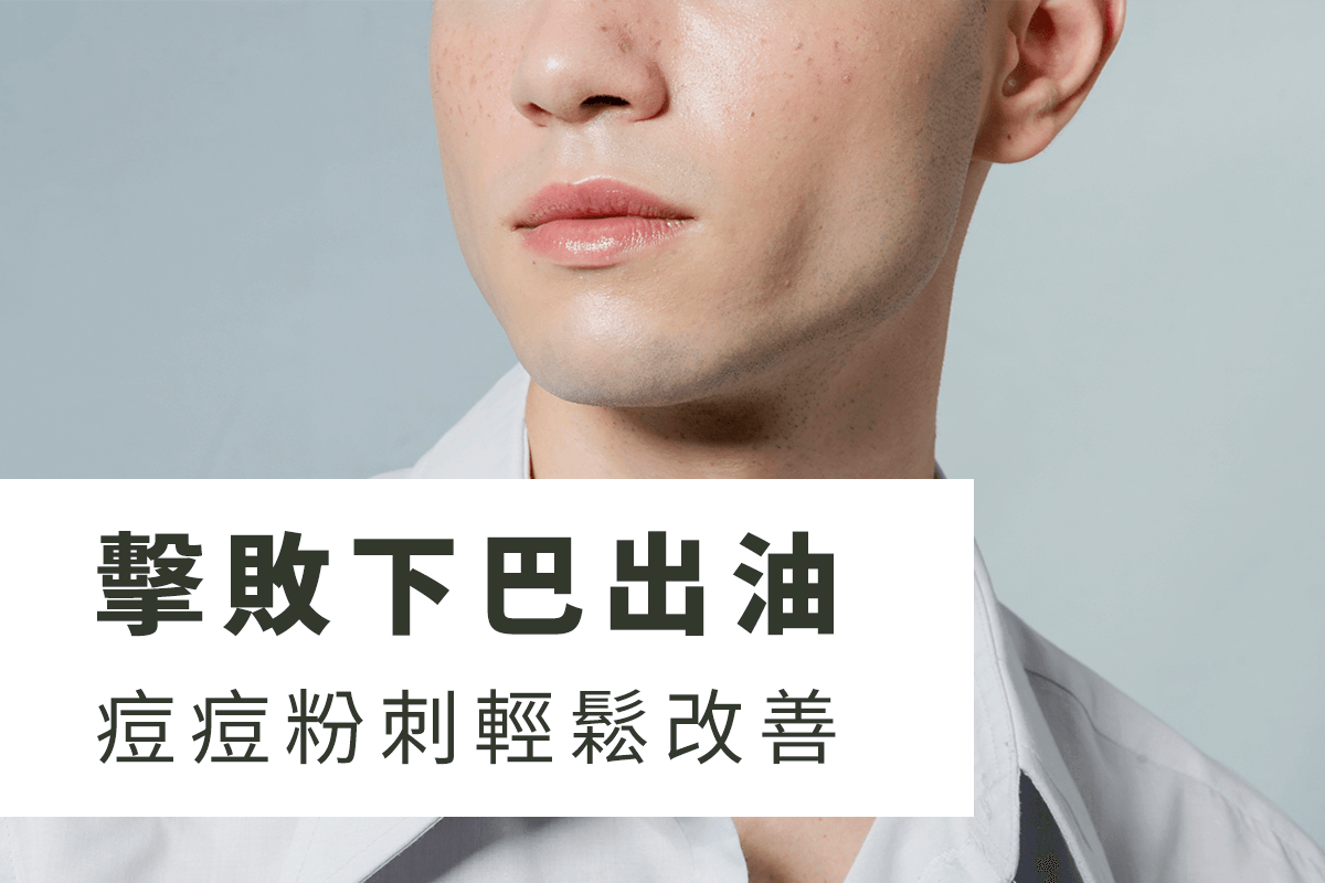 擊敗下巴出油！痘痘粉刺輕鬆改善