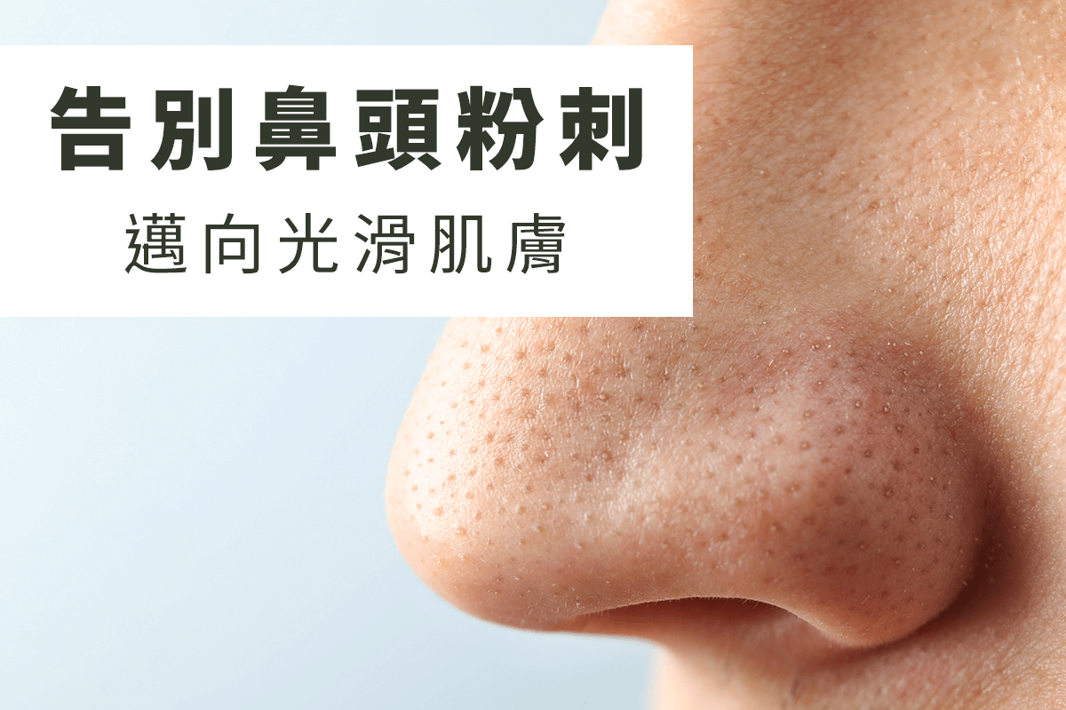 鼻頭粉刺清除：告別鼻頭粉刺，邁向光滑肌膚