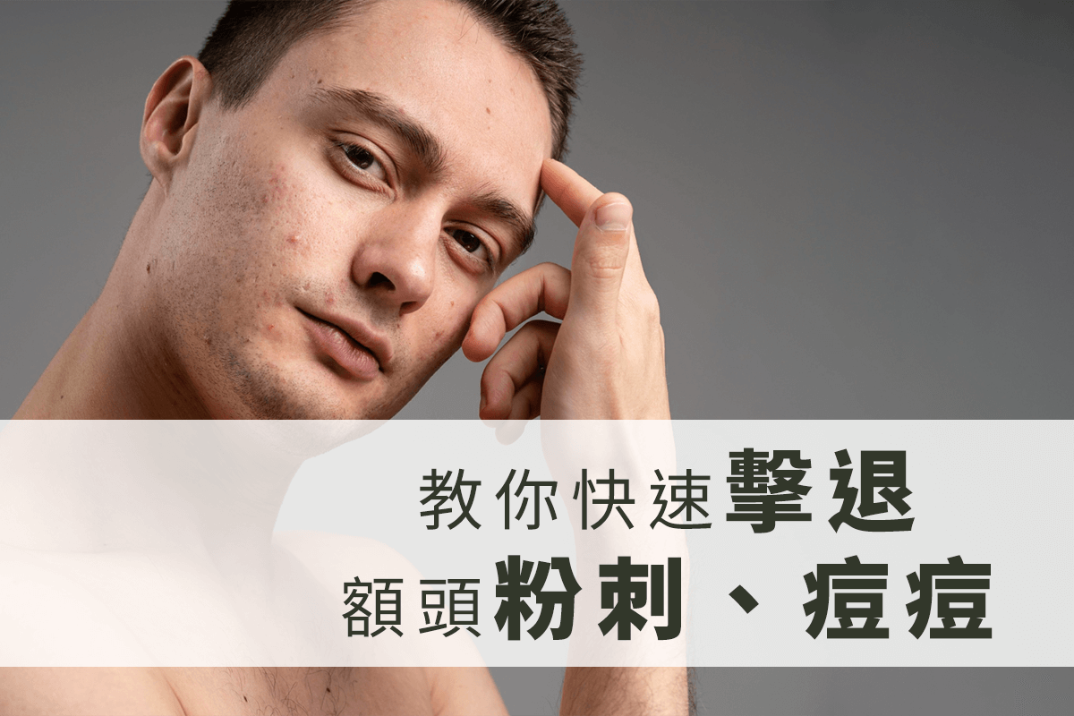 痘痘很癢？不要慌，解密臉部痘痘會癢的原因！