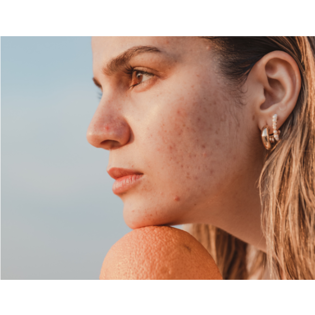 微晶魔幻煥白柔嫩肌