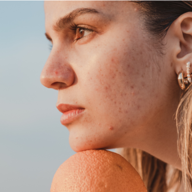 微晶魔幻煥白柔嫩肌