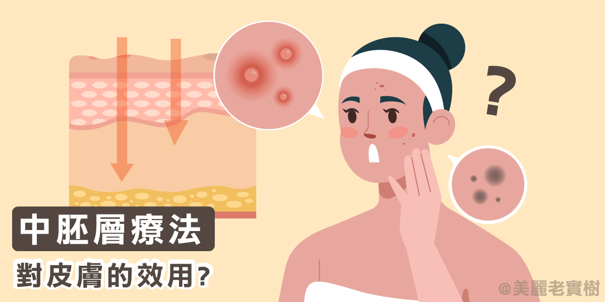 微整形中胚層療法有哪些? 微針與水光針，看了你會忍不住很想試看看!