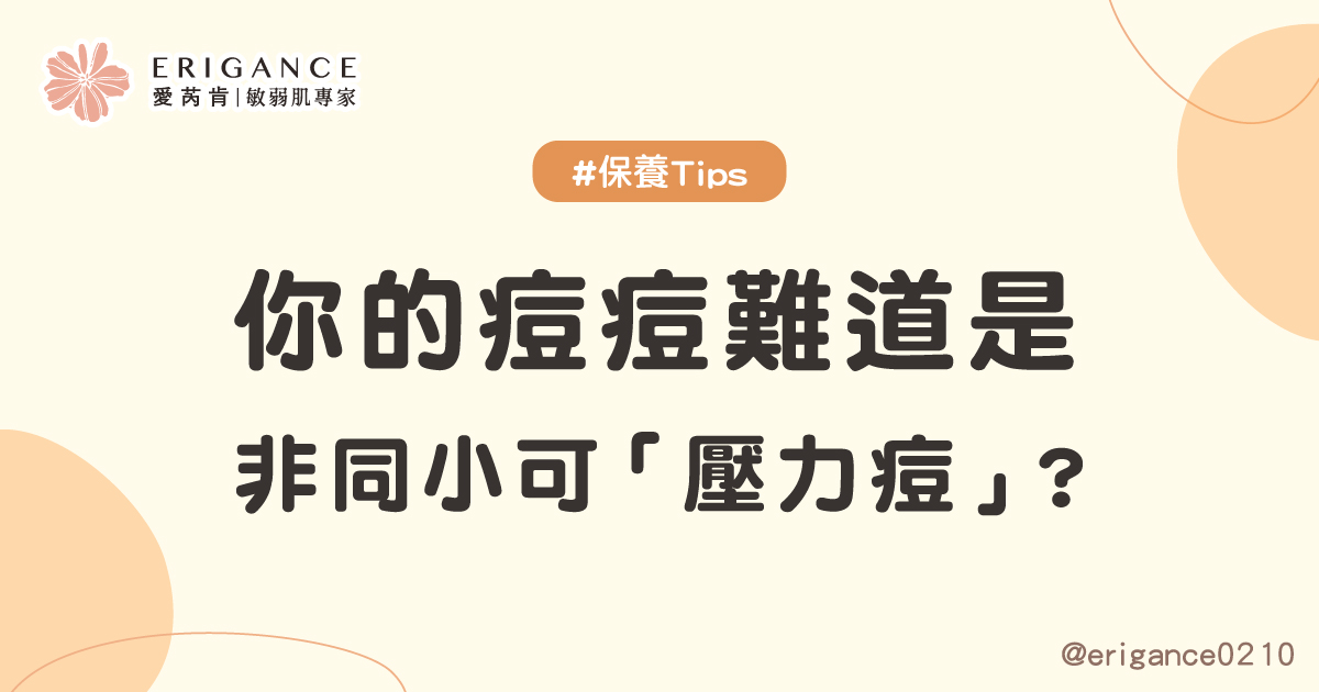 你的痘痘難道是非同小可壓力痘 ？