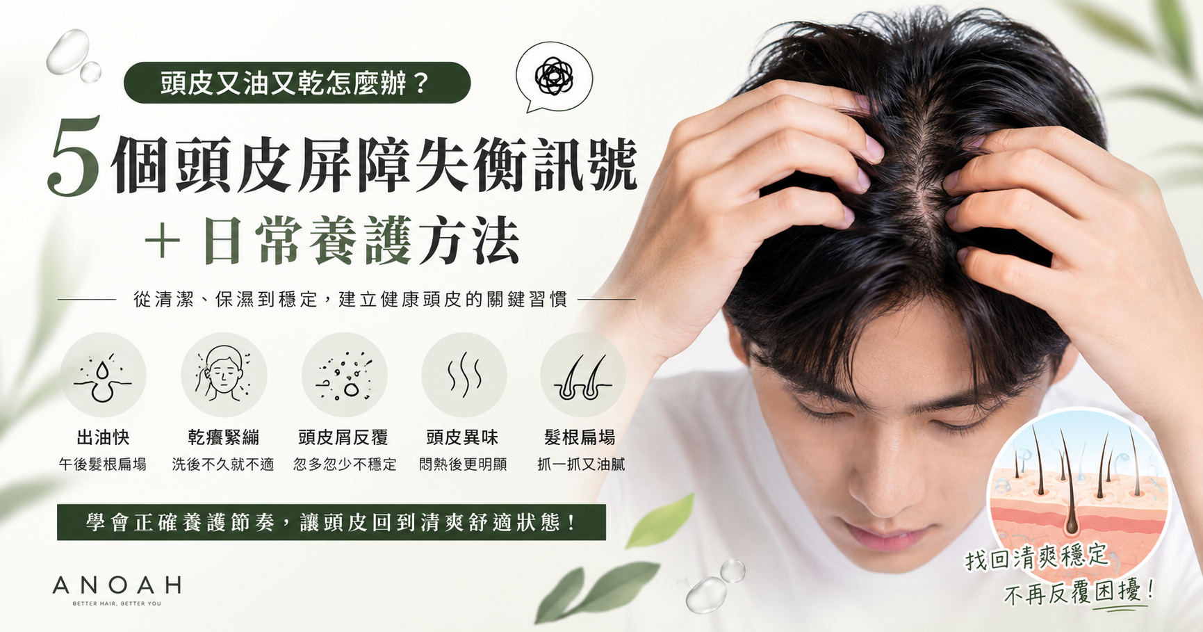頭皮又油又乾怎麼辦？5個頭皮屏障失衡訊號＋日常養護方法