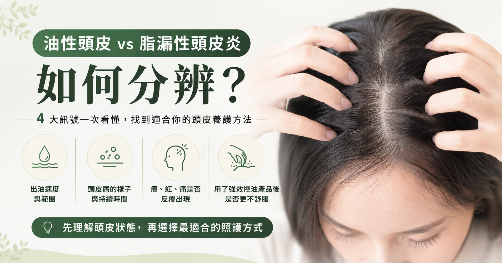 油性頭皮和脂漏性頭皮差在哪?4個判斷線索,分清出油與頭皮警訊