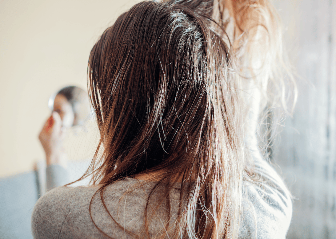 為什麼天天洗頭，頭皮還是很油？