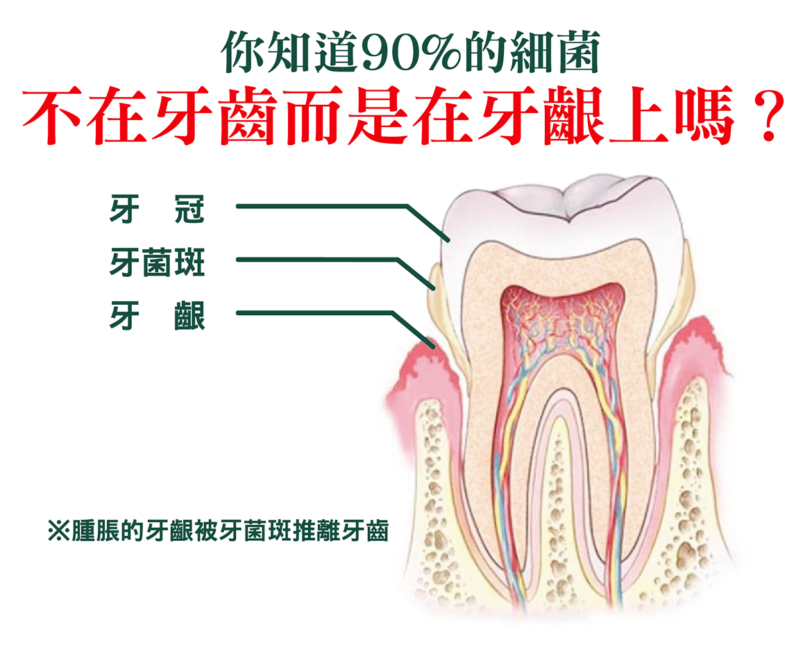 百分之90的細菌不在牙齒,而是在牙齦